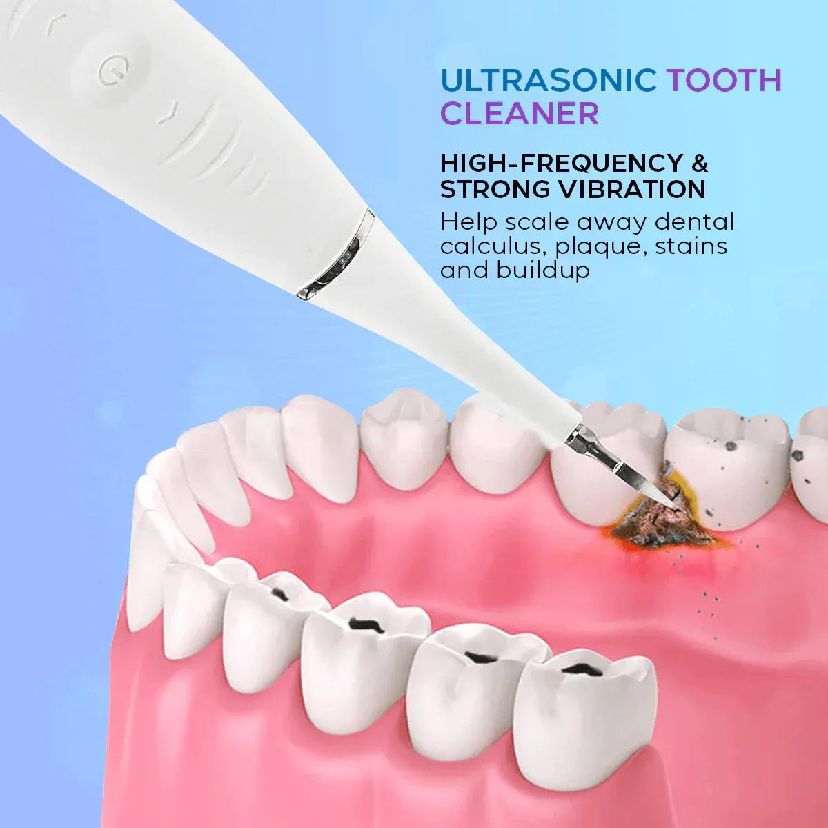 Removedor de sarro Eléctrico Dental Pro Max®  Sonrisa Radiante en Casa en Minutos + Envio Gratis + Regalo