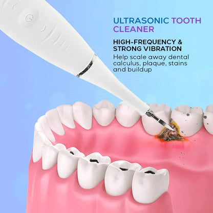 Removedor de sarro Eléctrico Dental Pro Max®  Sonrisa Radiante en Casa en Minutos + Envio Gratis + Regalo